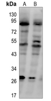 CD2 Rabbit Polyclonal Antibody