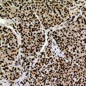 CD2 Rabbit Polyclonal Antibody