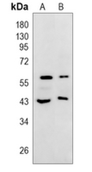 Heparanase Rabbit Polyclonal Antibody
