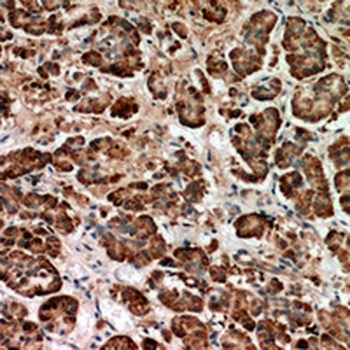 Heparanase Rabbit Polyclonal Antibody