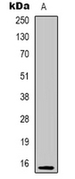 PHLDA3 Rabbit Polyclonal Antibody