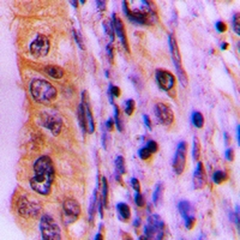 PHLDA3 Rabbit Polyclonal Antibody