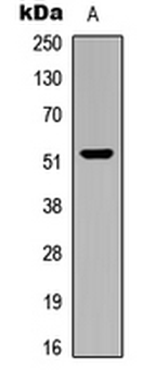 CARKL Rabbit Polyclonal Antibody