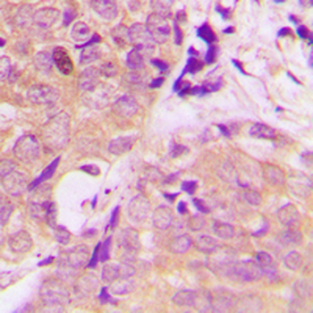 CARKL Rabbit Polyclonal Antibody