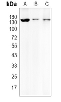 HDAC4 Rabbit Monoclonal Antibody