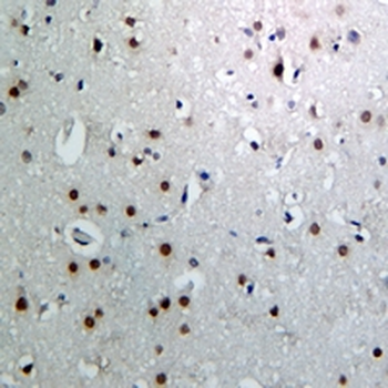 HDAC4 Rabbit Monoclonal Antibody