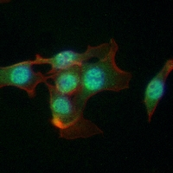 HDAC4 Rabbit Monoclonal Antibody