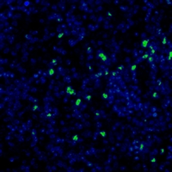 Ly6g Rabbit Monoclonal Antibody