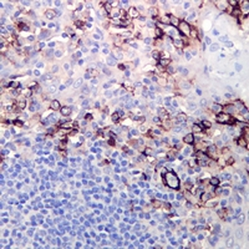 CD31 Rabbit Monoclonal Antibody