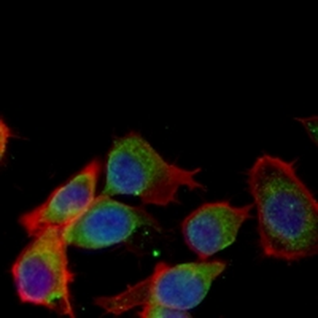 CD31 Rabbit Monoclonal Antibody