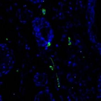 CD31 Rabbit Monoclonal Antibody