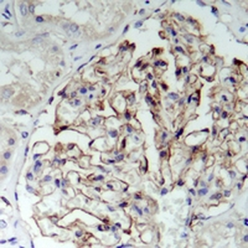 ZO1 Rabbit Monoclonal Antibody