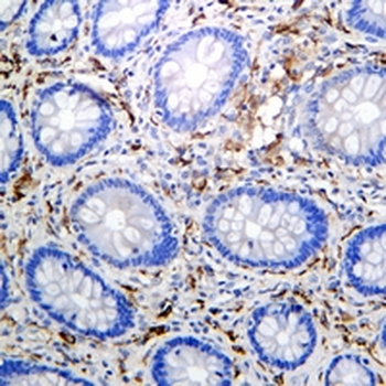 CD206 Rabbit Monoclonal Antibody