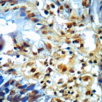 Ki67 Rabbit Monoclonal Antibody