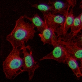 Ki67 Rabbit Monoclonal Antibody