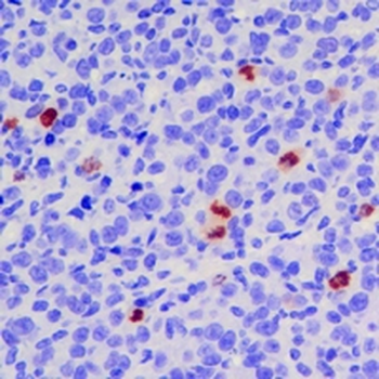 Ki67 Rabbit Monoclonal Antibody