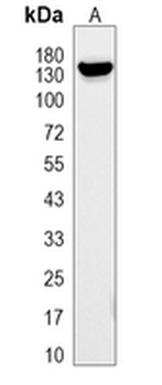 CD41 Rabbit Monoclonal Antibody