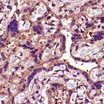 CD41 Rabbit Monoclonal Antibody