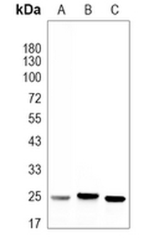 EIF4E (Phospho-S209) Rabbit Monoclonal Antibody