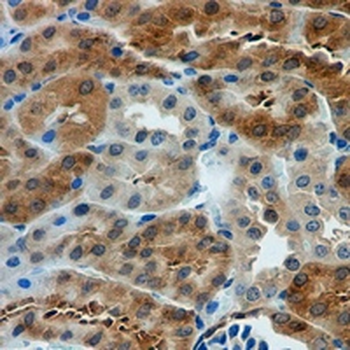EIF4E (Phospho-S209) Rabbit Monoclonal Antibody