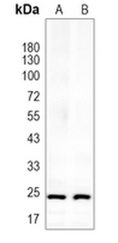 IFN gamma Rabbit Monoclonal Antibody