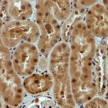 NOX4 Rabbit Monoclonal Antibody