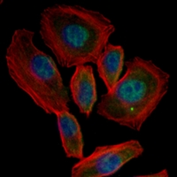 NOX4 Rabbit Monoclonal Antibody