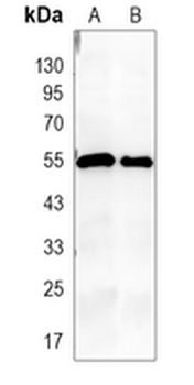 CD4 Rabbit Monoclonal Antibody