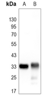 CDK4 Rabbit Monoclonal Antibody