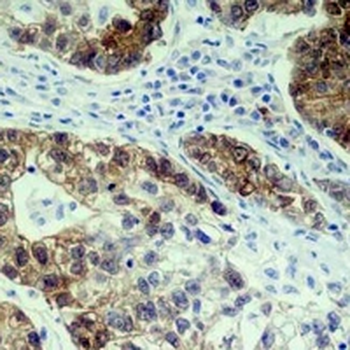 CDK4 Rabbit Monoclonal Antibody