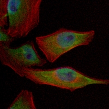 CDK4 Rabbit Monoclonal Antibody