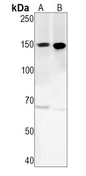 PLC beta 3 Rabbit Monoclonal Antibody