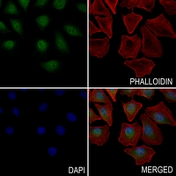 PLC beta 3 Rabbit Monoclonal Antibody