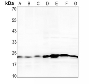 Glyoxalase I Rabbit Monoclonal Antibody