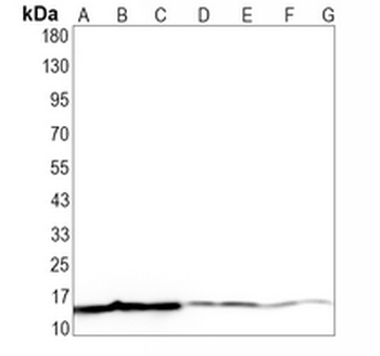 PLA2G2A Rabbit Monoclonal Antibody