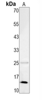 CRABP1 Rabbit Monoclonal Antibody