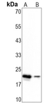 TNNI2 Rabbit Monoclonal Antibody
