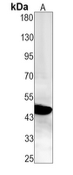 p47 phox Rabbit Monoclonal Antibody