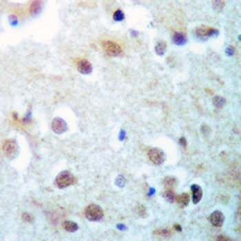 ENT2 Rabbit Monoclonal Antibody
