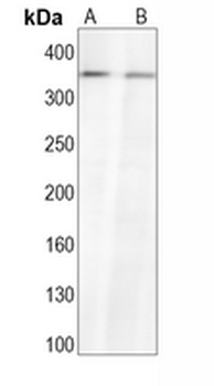 ATM Rabbit Monoclonal Antibody