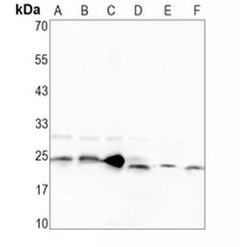 TCF6 Rabbit Monoclonal Antibody