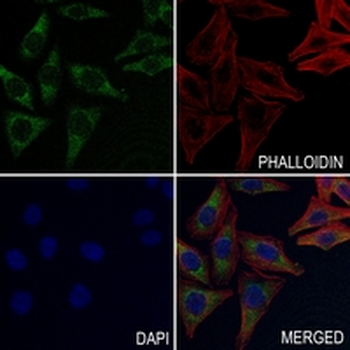 TCF6 Rabbit Monoclonal Antibody