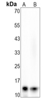 CXCL4 Rabbit Monoclonal Antibody