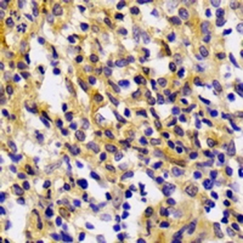CXCL4 Rabbit Monoclonal Antibody
