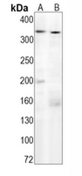 IP3R Rabbit Monoclonal Antibody