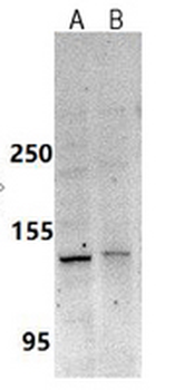 IP3R Rabbit Monoclonal Antibody
