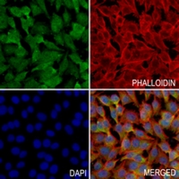 BNIP3L Rabbit Monoclonal Antibody