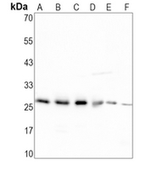 BNIP1 Rabbit Monoclonal Antibody