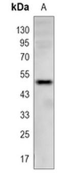CaMK2 delta Rabbit Monoclonal Antibody