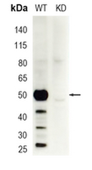 CaMK2 delta Rabbit Monoclonal Antibody